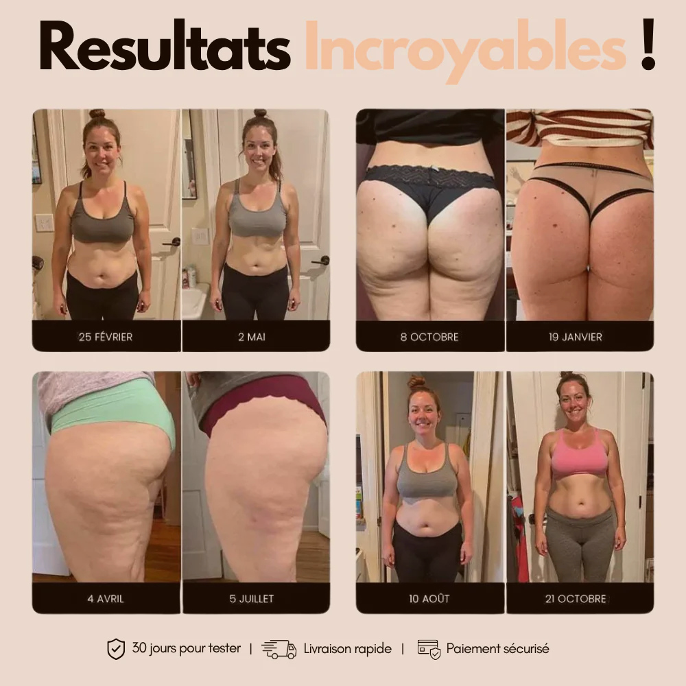 Leggings Anti Cellulite 3D